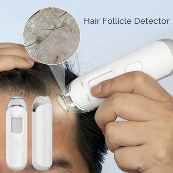 Nuovo 50X/200X Follicoli Dei Capelli Rilevatore Del Cuoio Capelluto Dermatoscopio Tester Analizzatore Della Pelle Macchina Per Il Cuoio Capelluto Diagnostico Strumenti Per La Cura Della Pelle
