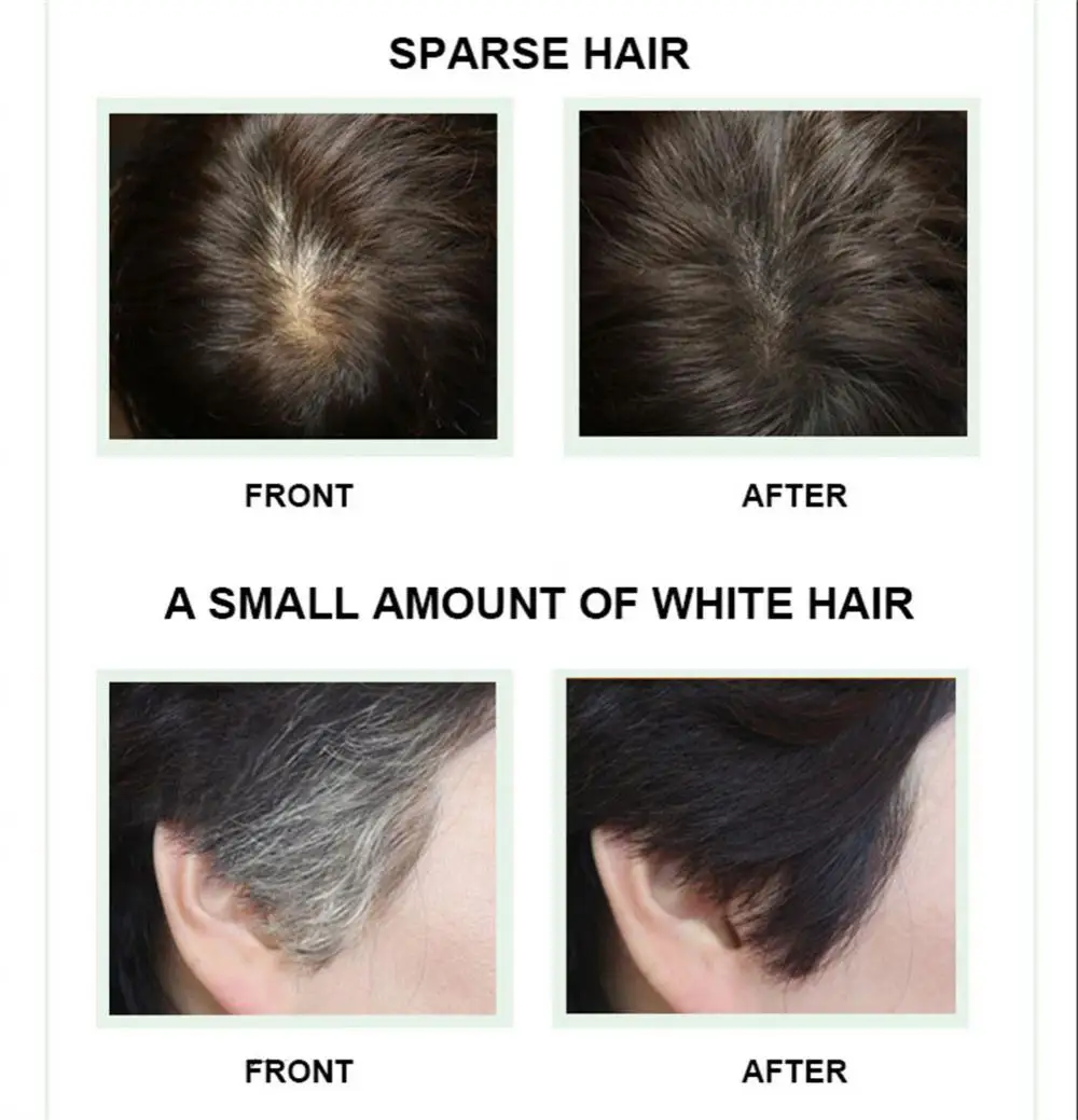 1/2PCS 12g Instantly Hairline Shadow Powder Hairline Refill Hair Powder Puff Waterproof Fluffy With Concealer Hair For