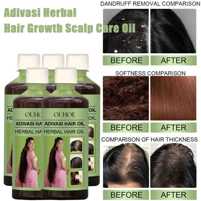100ml huile de croissance des cheveux inde Adivasi soins capillaires à base de plantes réparation au romarin hydrater endommagé hydrater le cuir chevelu réduire les pellicules 1