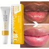 Fast Lightening Pink Mouth Lips Serum Bleaching Permanent Remove Dark Smoke Lips Lip Balm Moisturize Gloss Lipstick Lip Serum 1