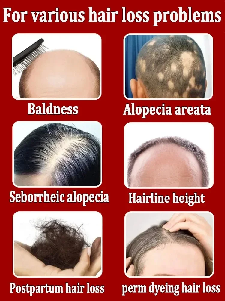 The Best Hair Growth Products of to Effectively Fix Baldness and Hair Loss