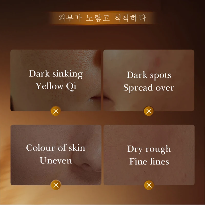 SADOER Rice Whitening Face Essence Facial Moisturizing Anti-Aging Moisturizing Hydrating Facial Serum Korean Skin Care Cosmetics