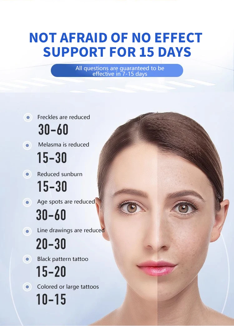 Creion laser cu picosecunde, îndepărtarea acneei, nevus, pete negre, pigment pentru tatuaje, hine_voghion.com