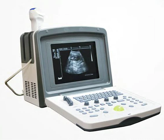 

Portable Ultrasound Machine & Laptop Ultra Sound Scanner Price