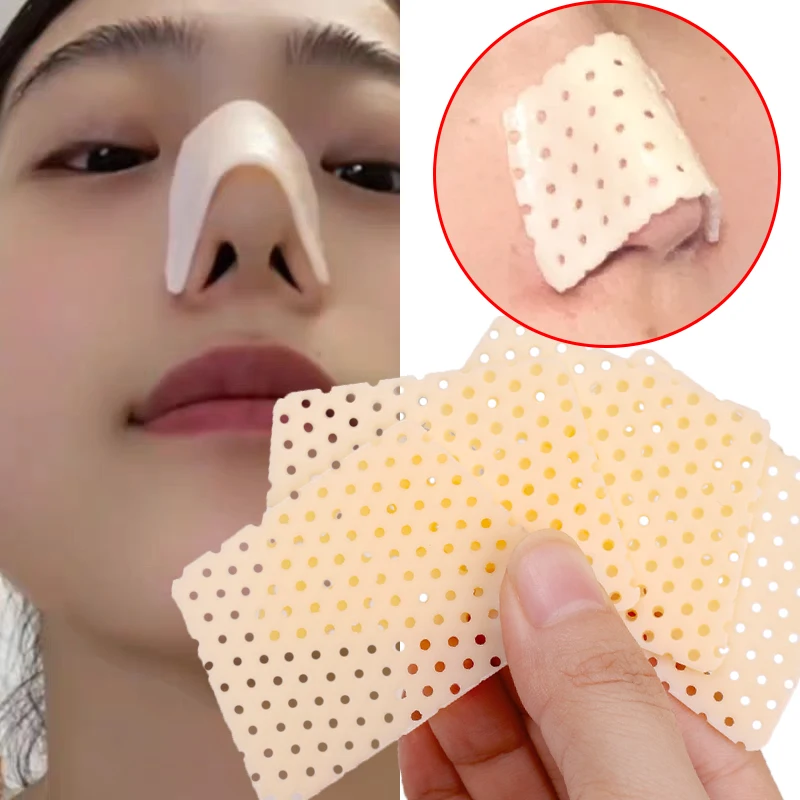 Thermoplastic Nose Splint for Fracture Support and Fixation