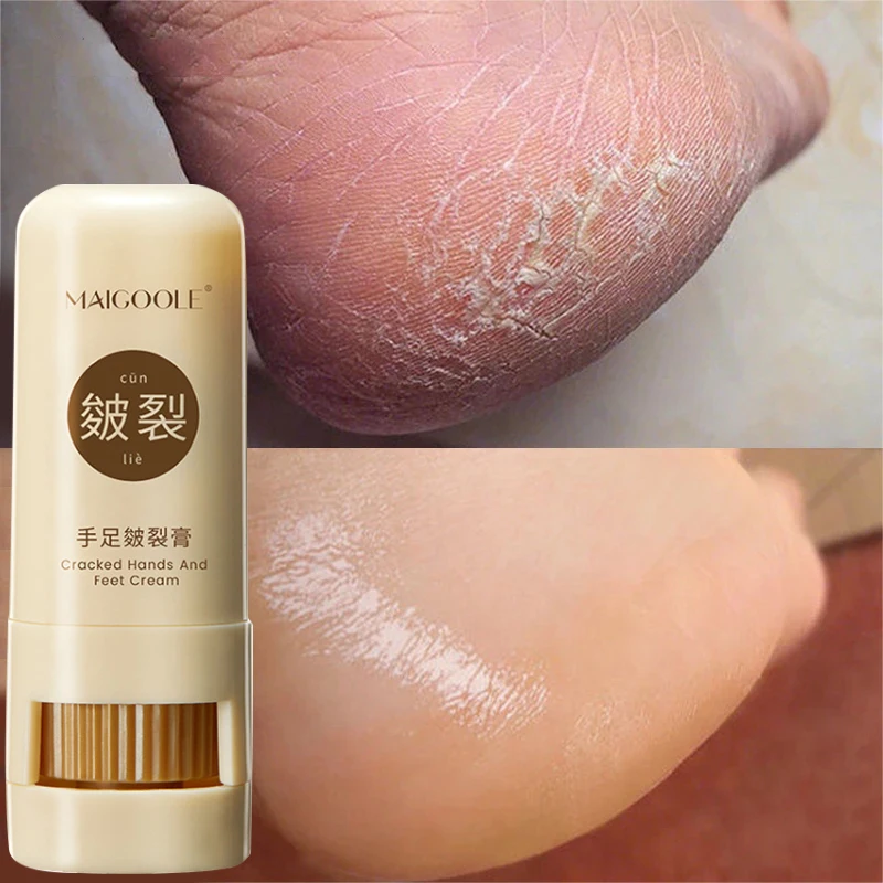 

Anti-Drying Crack Foot Cream Heel Cracked Mositurizing Repairing Peeling Cream Removal Dead Skin Nourishing Smooth Feet Care