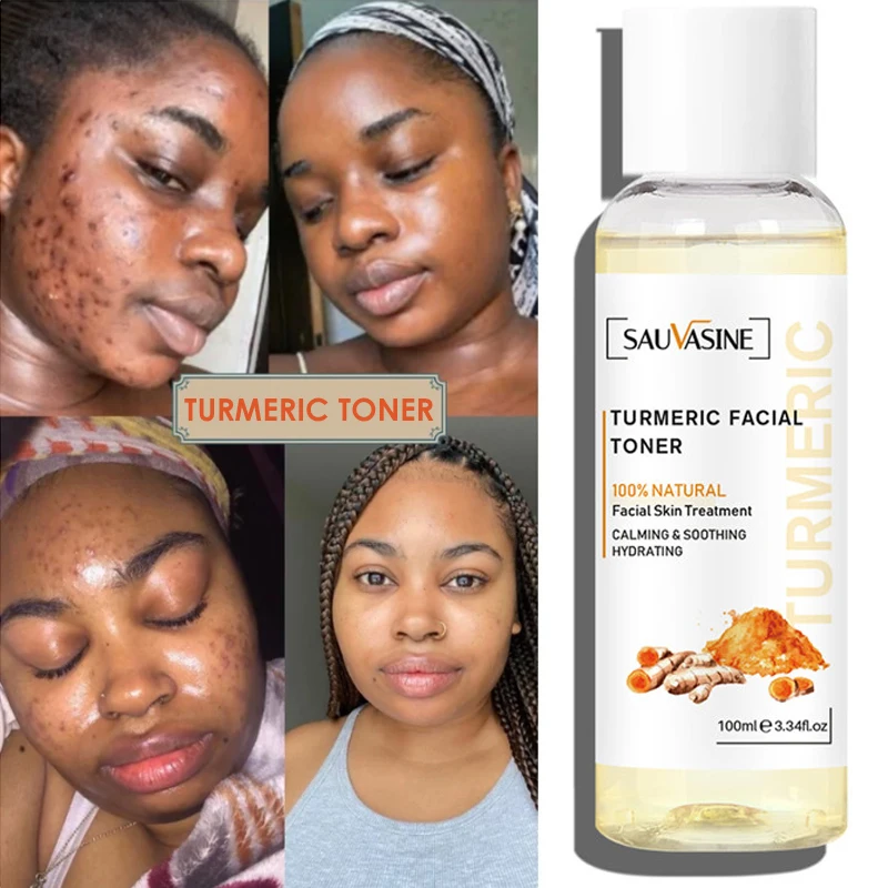 TurmerictonerDarkSpotCorrectorTurmericFadesBlemishesDarkSpots