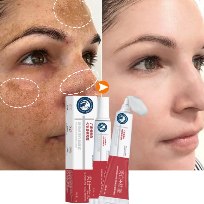 Powerful Whiten Freckle Cream Removal Face Dark Spot Melasma Anti-Pigmentation Fade Melanin Improve Dullness Brighten Skin Care