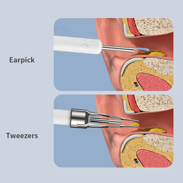 Dearsee 2300p Visual Ear Cleaner with Camera Ear Wax Removal Tool with Ear Pick & Tweezers 7 Ear Spoons Earwax Removal Ears Care 2