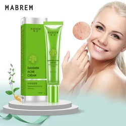 MABREM Acne Removal Cream Acne Treatment Fade Acne Spots Oil Control Shrink Pores Whitening Moisturizing Acne Cream Skin Care