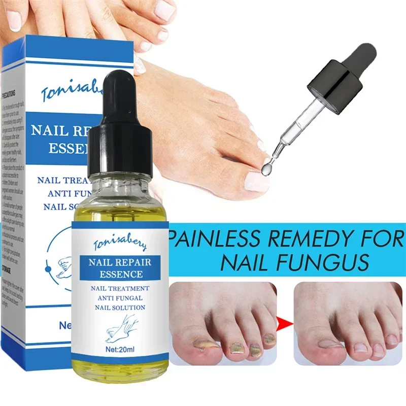 

Nail Fungus Treatment Serum Anti fungal Foot Toe Nails Repair Gel Anti-Infection Onychomycosis Paronychia Essence Care Body Care