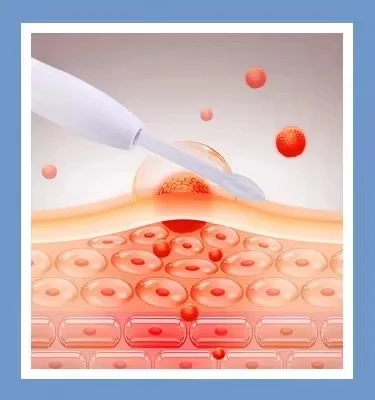 Macchina per il viso con scrubber per ossigenazione a bolle per attrezzature estetiche per bellezza da donna 14 in 1 6