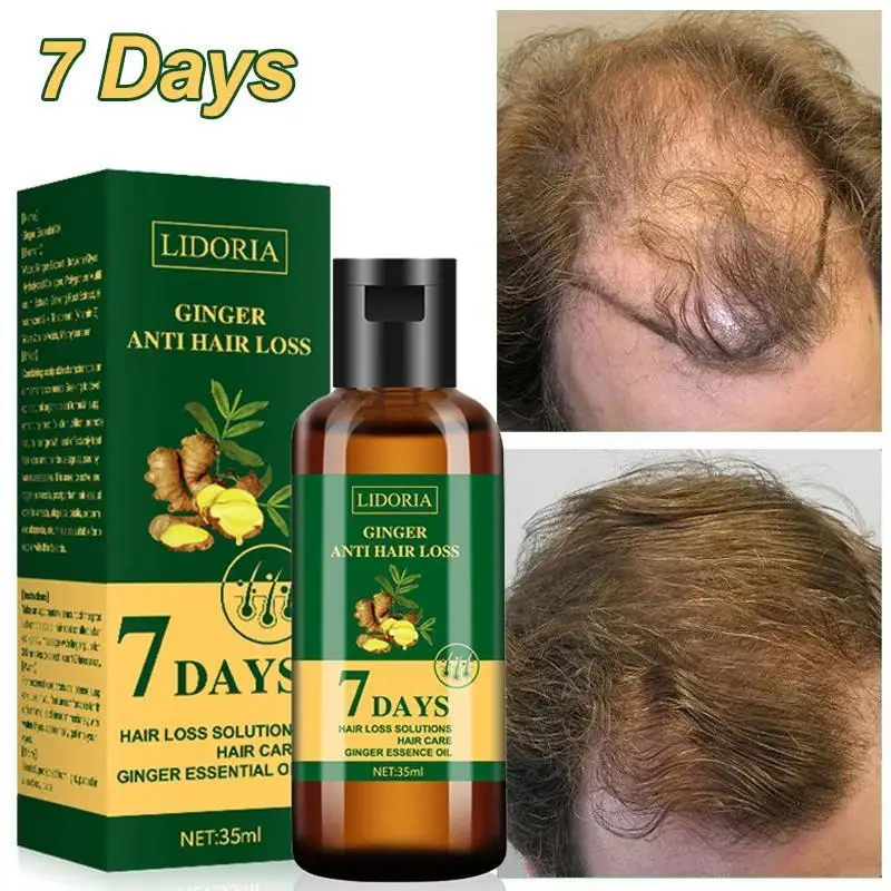 

Ginger Hair Growth Serum Fast Growing Hair Care Oil Anti Hair Loss Baldness Scalp Treatment Repair Damaged Hair for Men Women