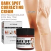 Dark Knuckle Bleaching Cream Fade Pigmentation Lightening Joint Elbow Knees Ankle Melanin Corrector Body Whitening Nourish Cream 3