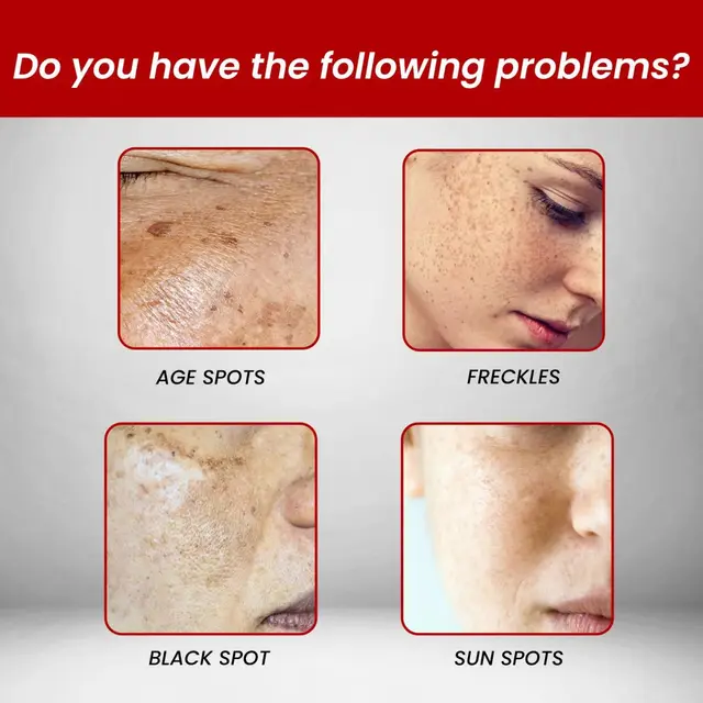 Vibrant Skin Vitamin C Cream Vibrant Skin Vitamin C Cream