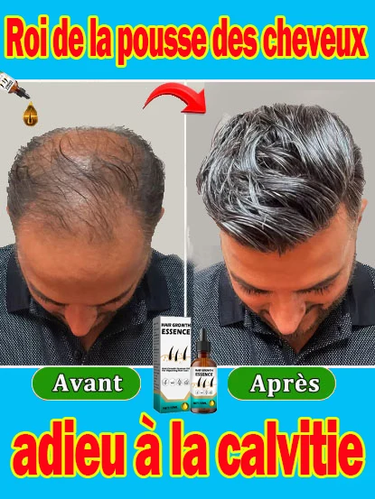 Dites Alfa Hair Care Repair Prevent Thinning