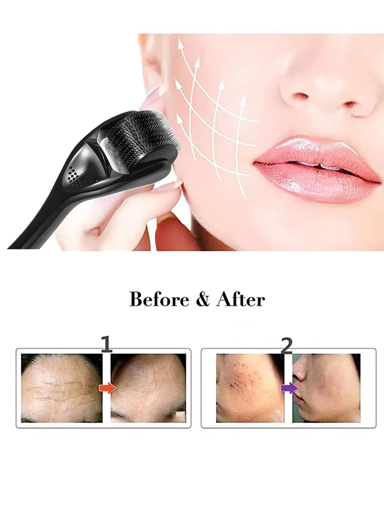 1 Pcs 540 Microneedle Rollers Dermatological Derma Micro Needles Titanium Help Hair Softens Acne Scars Skin Face Care Tool