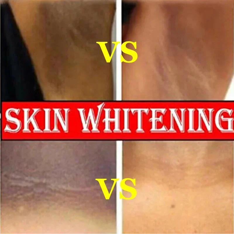 Whitening Cream Private Parts Underarm Bleaching Serum Whiten Butt Knee Brighten Inner Thigh Intimate Parts Dark Remove Melanin 3