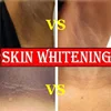 Whitening Cream Private Parts Underarm Bleaching Serum Whiten Butt Knee Brighten Inner Thigh Intimate Parts Dark Remove Melanin 3
