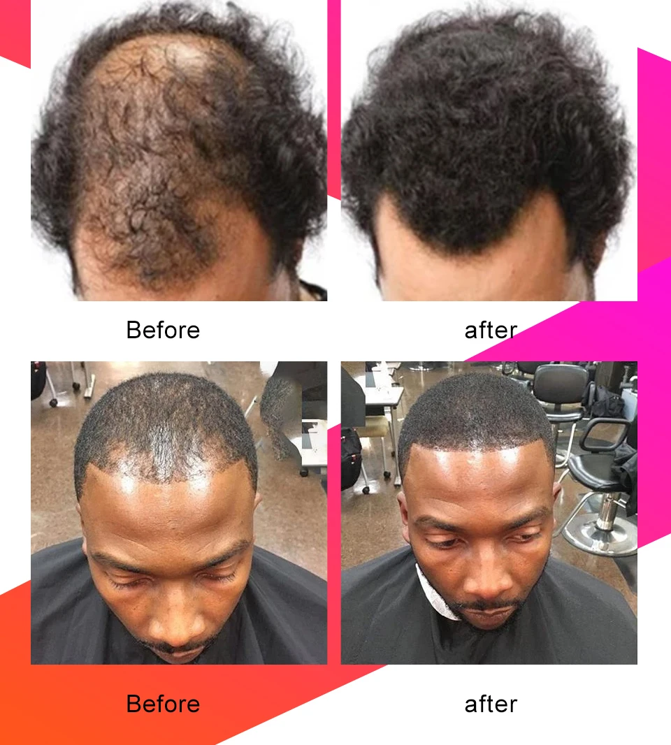 Description Picture 4 of itemChebe Hair Mask Anti Hair Break Hair Strengthener Hair Loss Treatment Spray Fast Hair Growth Oil African Crazy Traction Alopecia