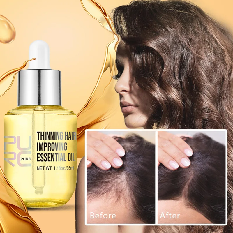

PURC Hair Growth Oil Ginger Prevent Treatment Hair Loss Essential Oil Fast Growing Scalp Skin Care Beauty Health for Men Women