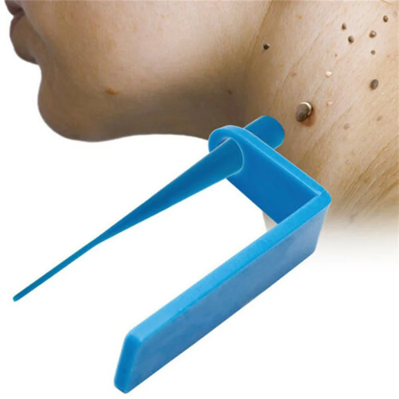 Skin Tag Removal Kit Micro Skin Tag Treatment Tool Home Use Mole Wart Remover Equipment Easy To Clean Beauty Care Tool