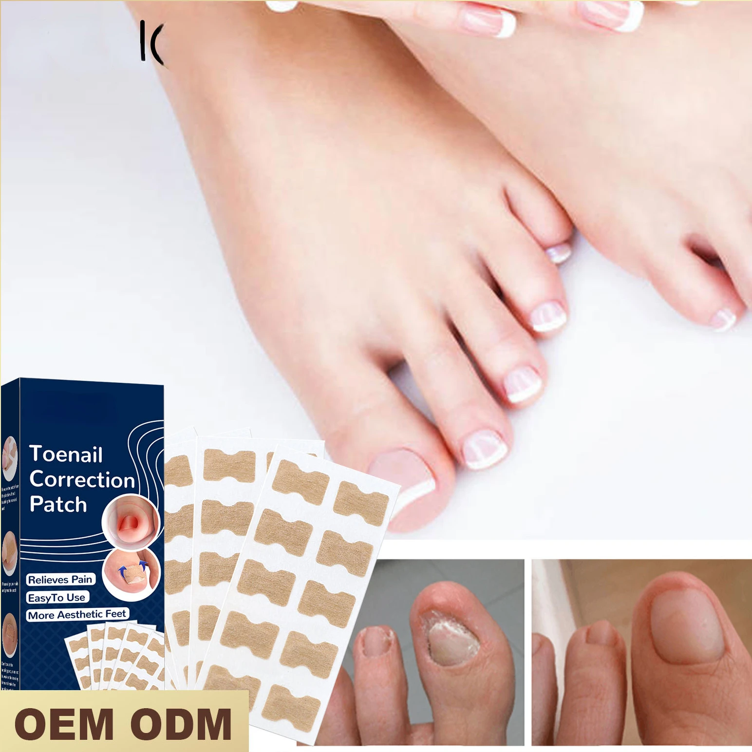 50pcs Nail Correction Stickers Ingrown Toenail Corrector Patches