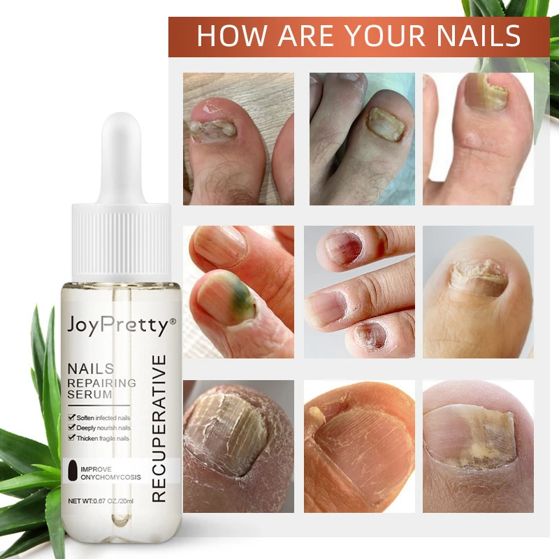 Nail Cuticle Remover Softener Liquid Exfoliator Cuticle Oil Treatment  Manicure Soften Dead Skin All for manicure Nails Care| | - AliExpress