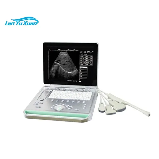 2023 CE Marked Best Digital Laptop Portable Ultrasound Scanner Color