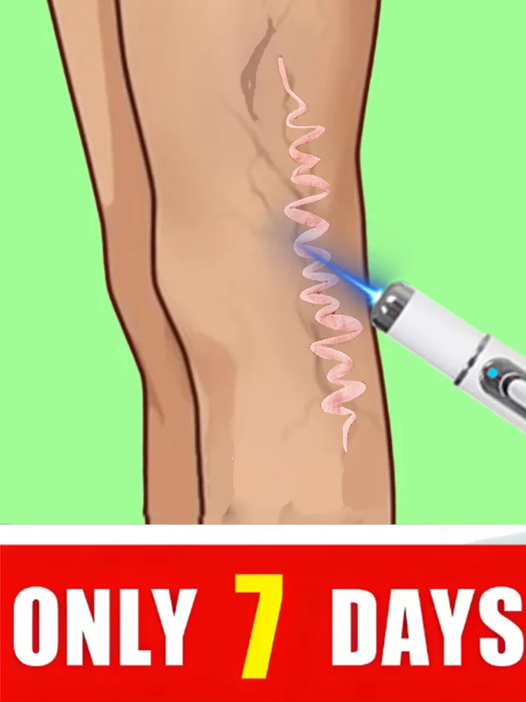 2025 Blue light pen and foot vein Tools for People with Limited Mobility