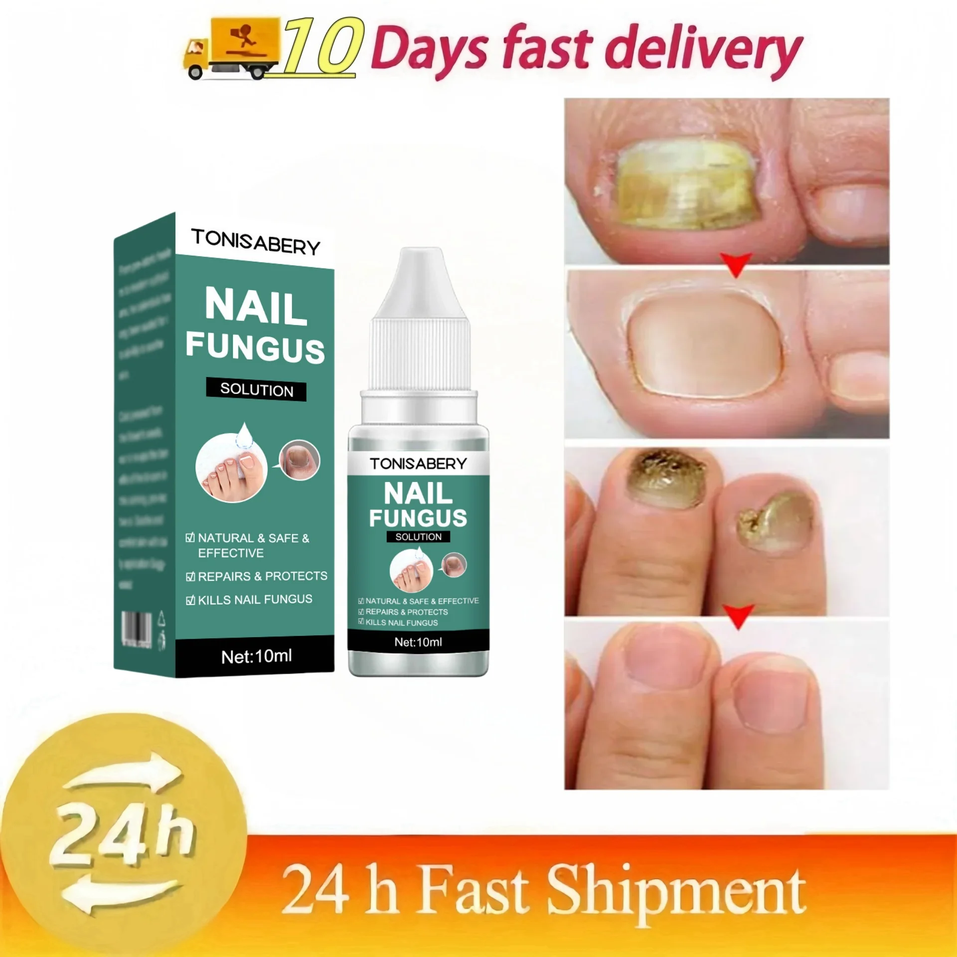 סרום לתיקון פטריות ציפורן רגל ציפורן הסרת פטריות שמן אתרי נגד דלקת אוניכומיקוזיס פרוניכיה טיפוח תיקון