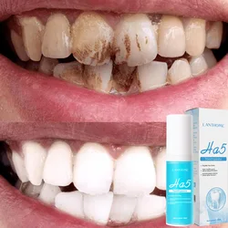 HA5 Repair Toothpaste Teeth Whitening Remover Plaque Stain Prevent Periodontitis Cleaning Oral Hygiene Fresh Breath Dental Tools