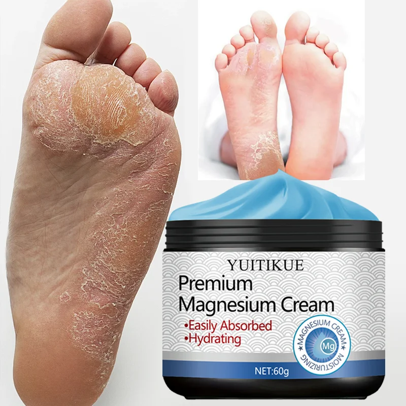 High-quality magnesium cream cares for the skin, absorbs easily, provides deep hydration, and is suitable for all skin types.
