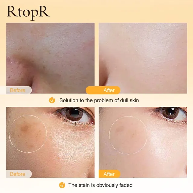 Rtopr C -Vitamin -Fehérítő Esszencia Mély Fényesíti A Bőr Tónusát, Hidratálja Táplálékokat - Image 3