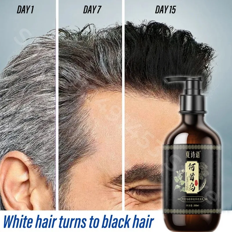 Black Ganoderma and Polygonum Multiflorum Plant Shampoo Repairs and Nourishes Damaged White Hair and Turns It Into Black Hair 3