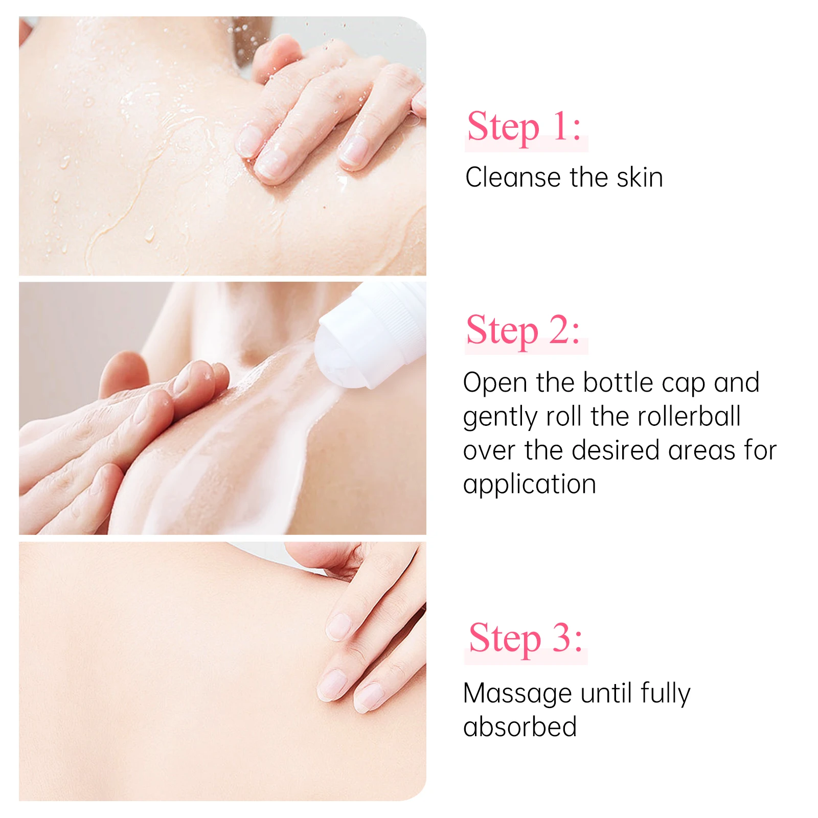 Chicken Skin Cream Keratosis Pilaris Treatment Chicken Remover Skin Repair Cream Body Lotion Moisturizing Whitening Smooth Care 4