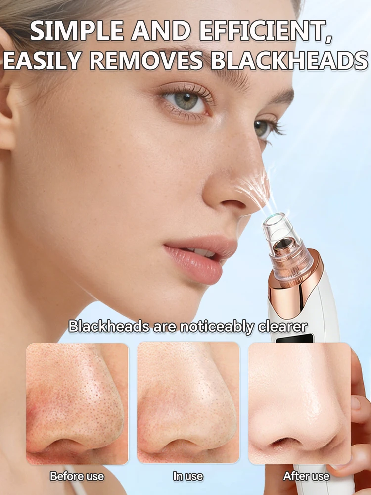 Generation-2, Removes impurities from the surface of the nose with high tech vacuum suction, say goodbye to blackheads and acne. 5