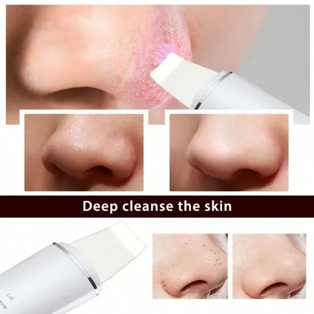Electric Pore Cleaner Blackhead Remover Vacuum Device Facial Skin Care