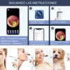 TESLONG 3.9mm Lens Wireless Otoscope 720P HD WiFi Ear Scope with 6 LED for Kids and Adults Support Android and iPhone 5