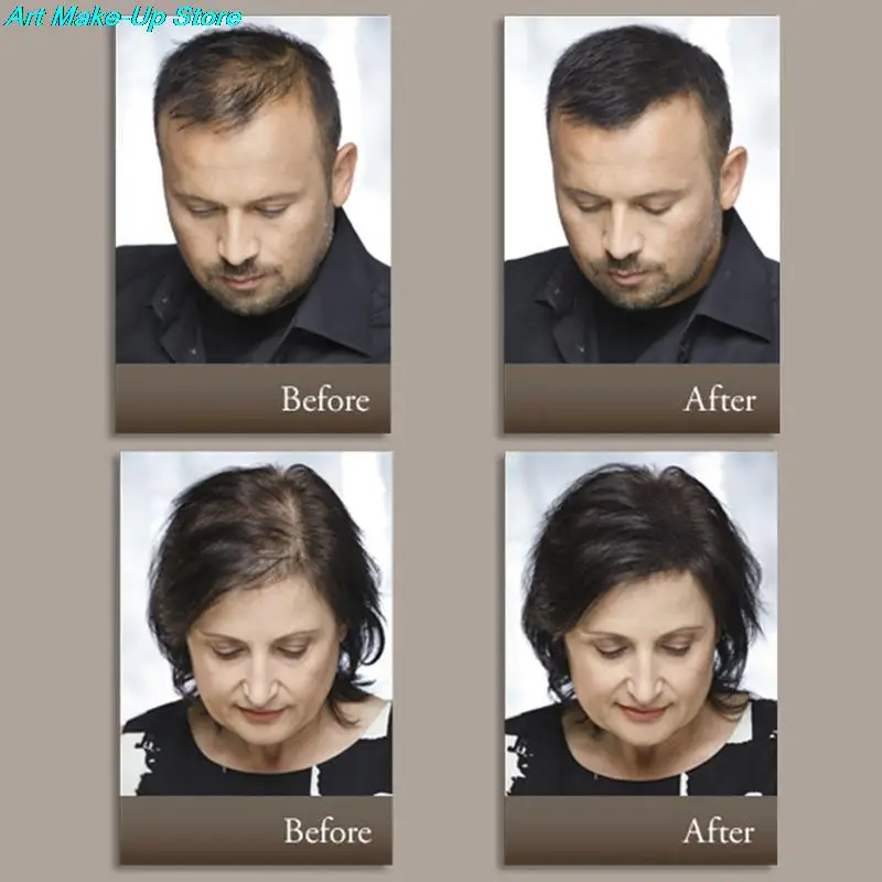 Immetee Full Hair Instantly Hair Building Fibers To Solve Your Thin Instantly Plant Fiber Temples Dense Powder