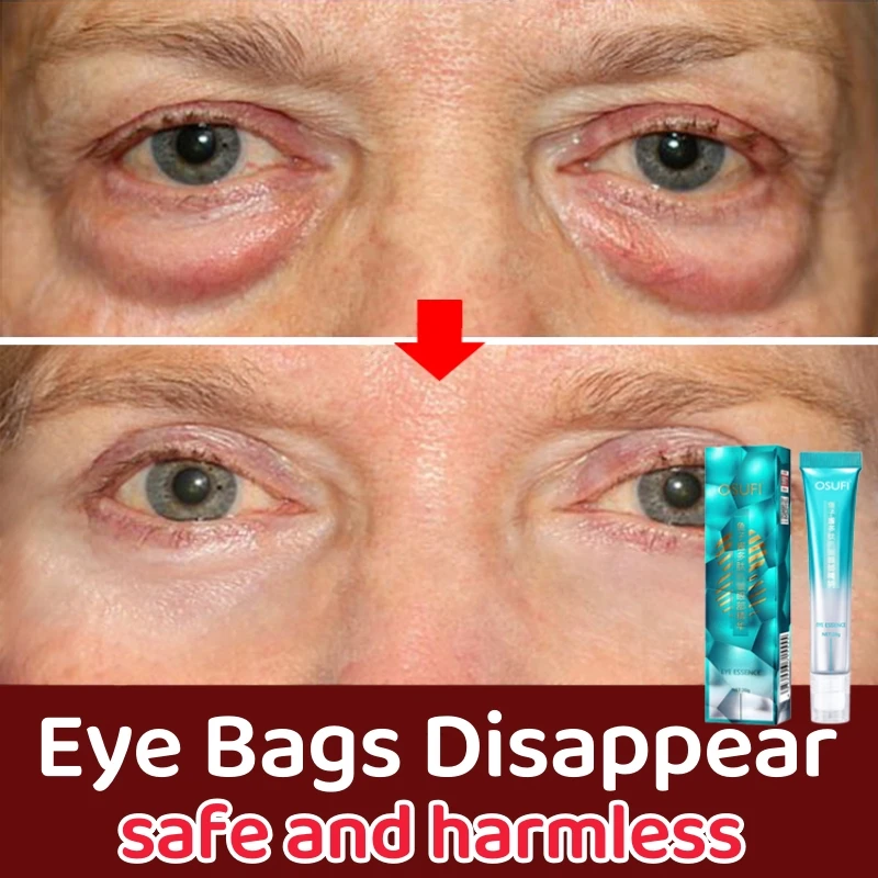 Anti-Wrinkle Eye Cream Instant Removal Puffy Dark Circles Bag Lift Firm Eye Area Sagging Skin Moisturize Smooth Eye Massage Care