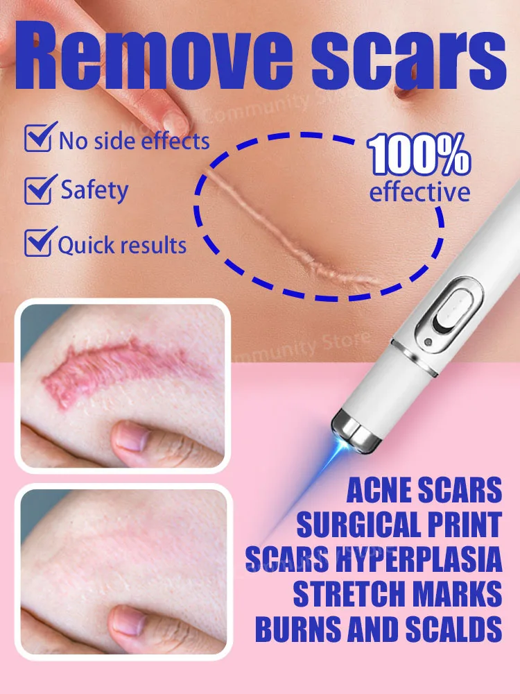 

scars are gone