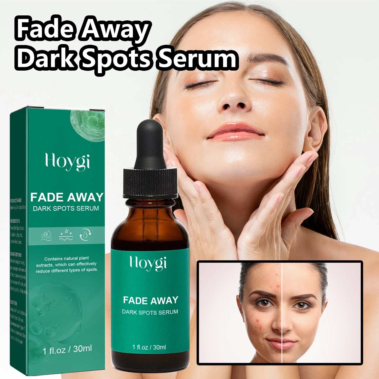 Dark Spot Remover Serum For Face Sun Melasma Freckles Pigment Age Spots Removal Freckle Whitening 5