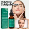 Dark Spot Remover Serum For Face Sun Melasma Freckles Pigment Age Spots Removal Freckle Whitening 5