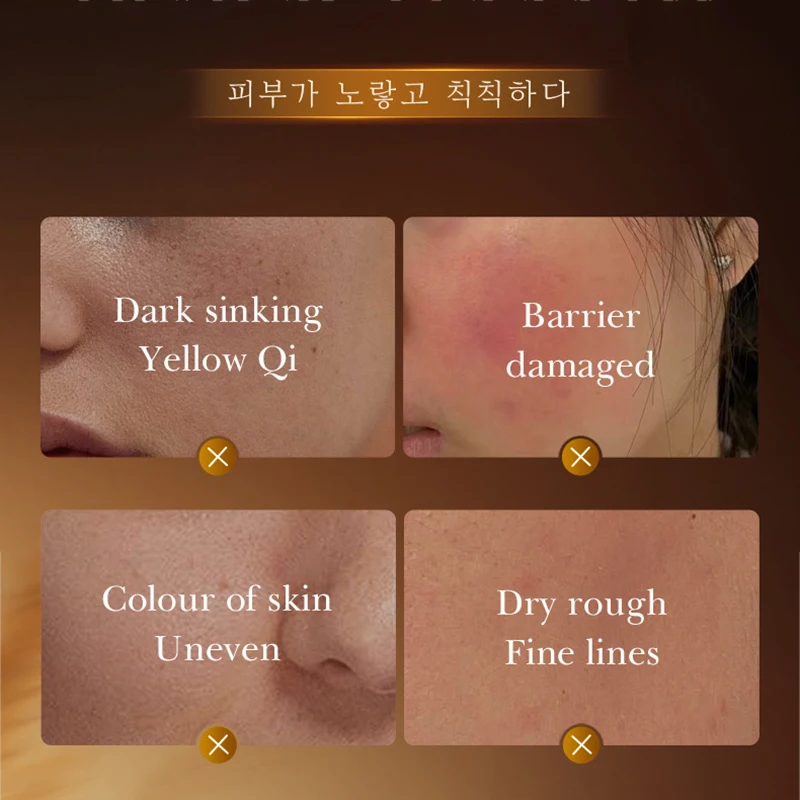 SADOER Rice Essence Serum Face Whitening Cream Moisturizing Hydrating Anti-aging Facial Essence Korean Skin Care Cosmetics
