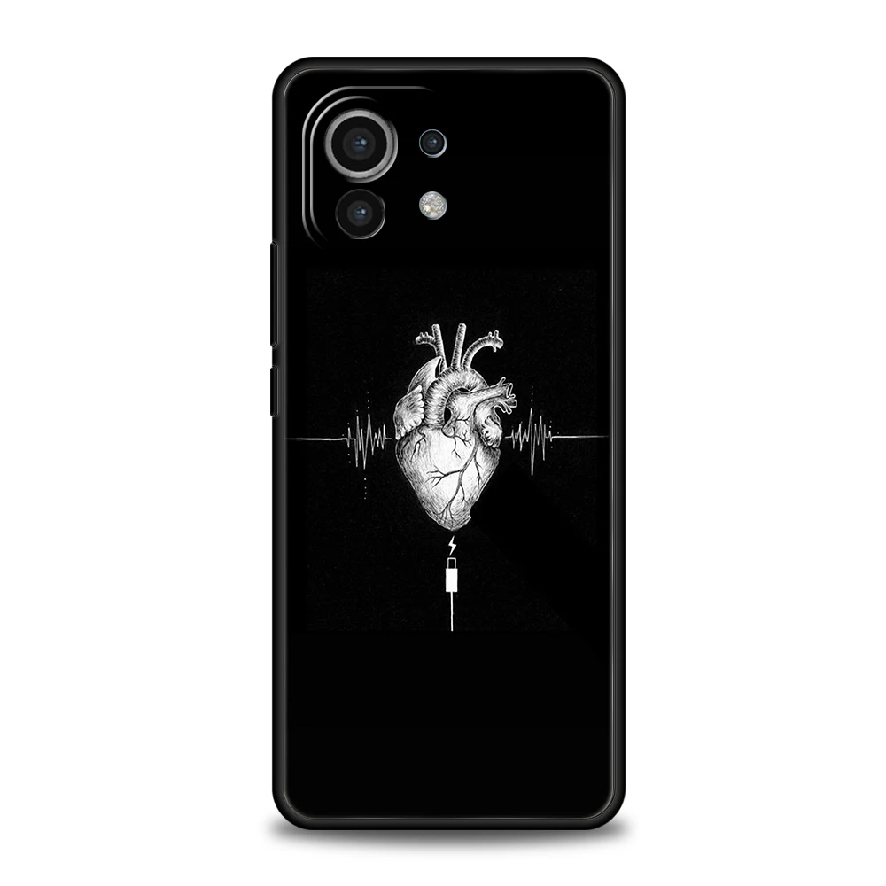 Herz Kunst Handy hülle für Xiaomi Poco F4 F3 X3 X4 X5 GT NFC M3 M4 11 Ultra 12 12T 13 Note 10 Pro Lite 5G Silikon hülle Capas Tasche – Detail 6