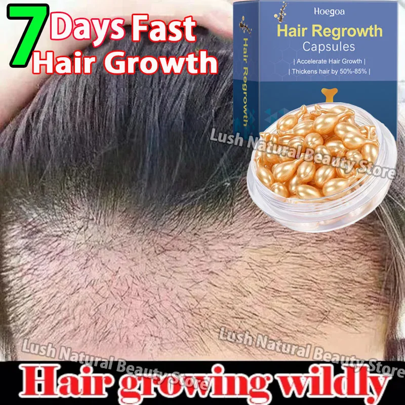 Hair Care Products Hair Growth Serum 7 Day Fast Regrowth Anti Hair loss