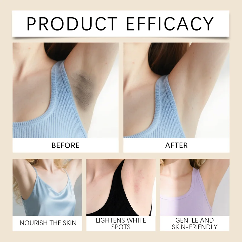 Underarm care cream, suitable for dull skin. Brightens underarms and acts as a moisturizer for intimate areas for women.