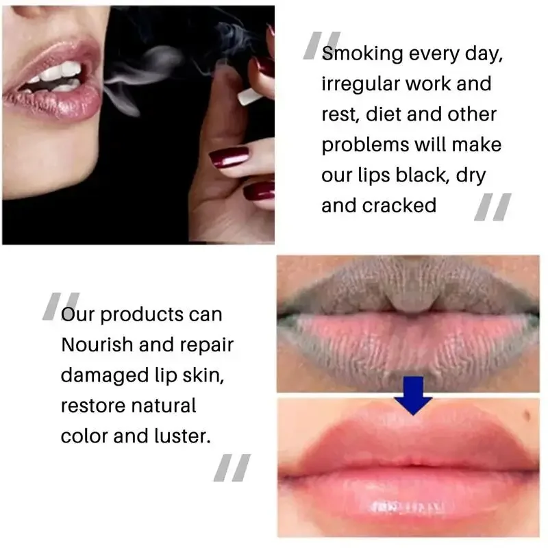 Remove Dark Lip Balm Lighten Melanin Lip Mask Exfoliating Fade Lip Line Dead Skin Moisturizing Brighten Repair Lip Care New