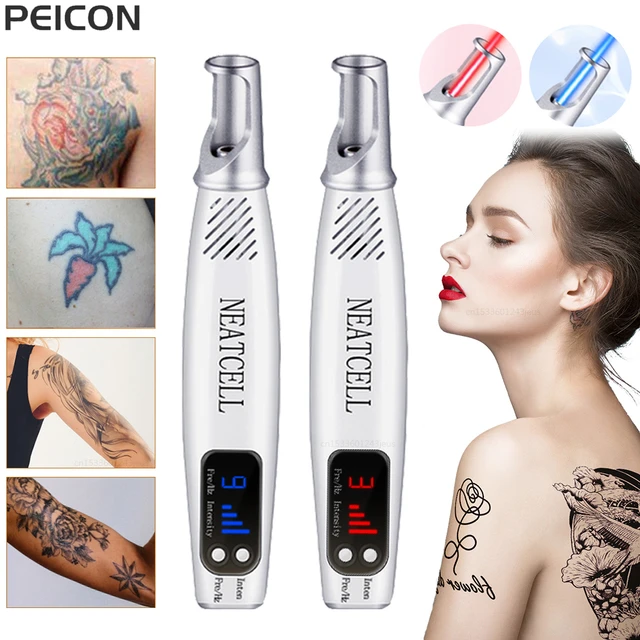 Buy Wholesale China Picosecond Laser Pen,blue Light Therapy,pigment Tattoo  Removal,dark Spot Remover Machine & Picosecond Laser Pen at USD 50